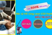 Thẩm mỹ viện tại Gia Lai>> Điều trị nám da, tàn nhang hiệu quả, triệt để tại Gia Lai